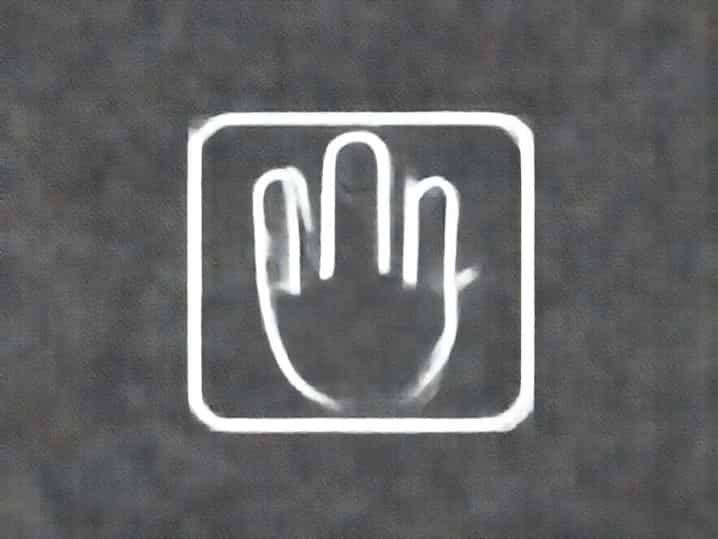 What Causes Clubbed Fingers