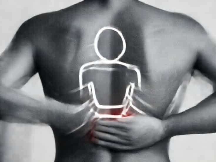 Cupping For Rhomboid Pain