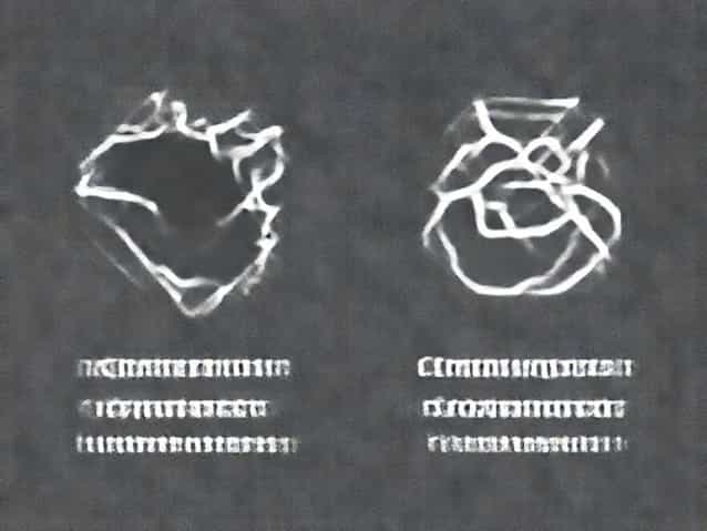 Distinguish Between Regional And Contact Metamorphism
