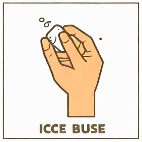 Should You Ice A Bruise