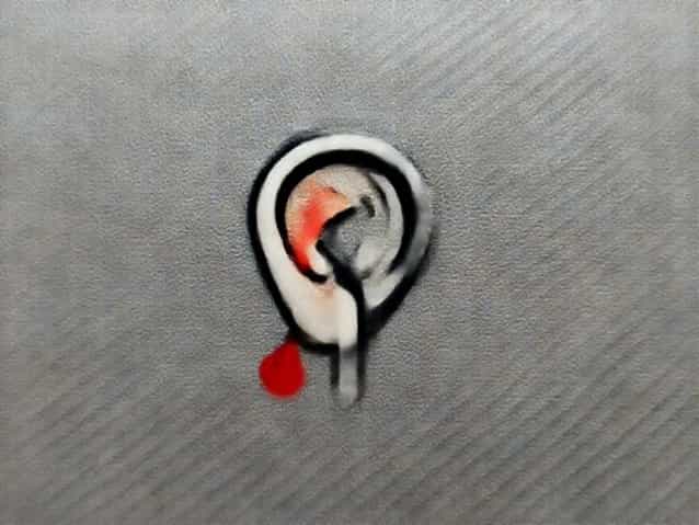Jammed Q Tip In Ear Bleeding