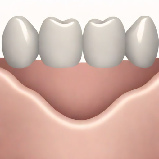 Zirconia Anterior Crown Prep