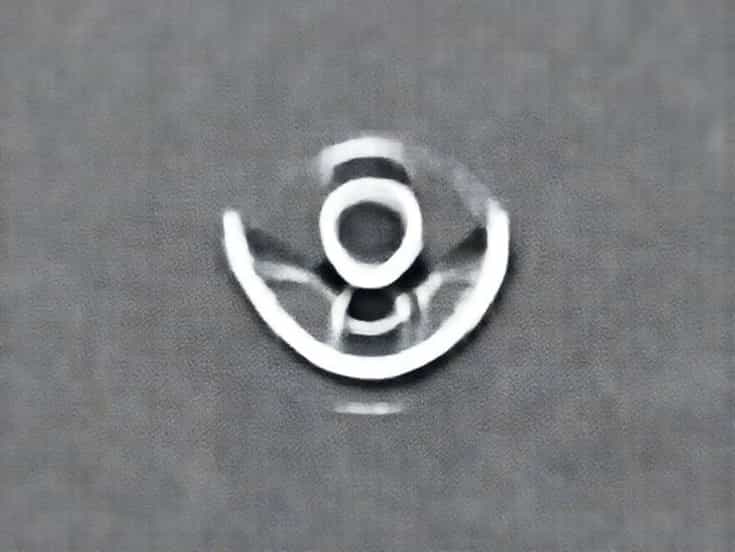 Carotid Bruit Icd 10