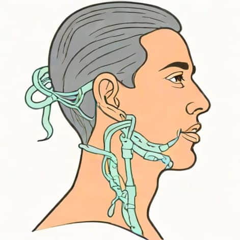 Recurrent Laryngeal Nerve Palsy
