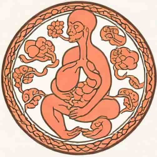 What Is Bipartite Placenta