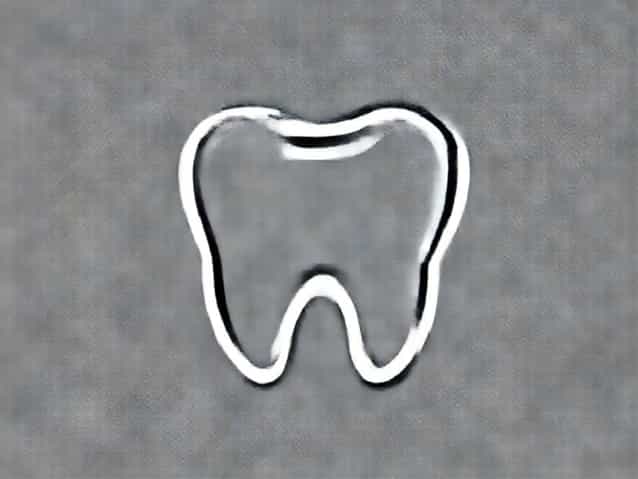 Calcium Buildup On Teeth