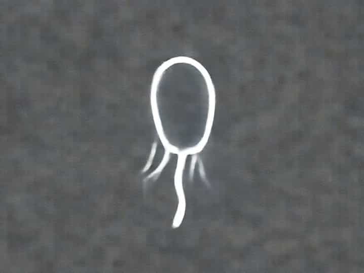 Vegetative Form Of Protozoa
