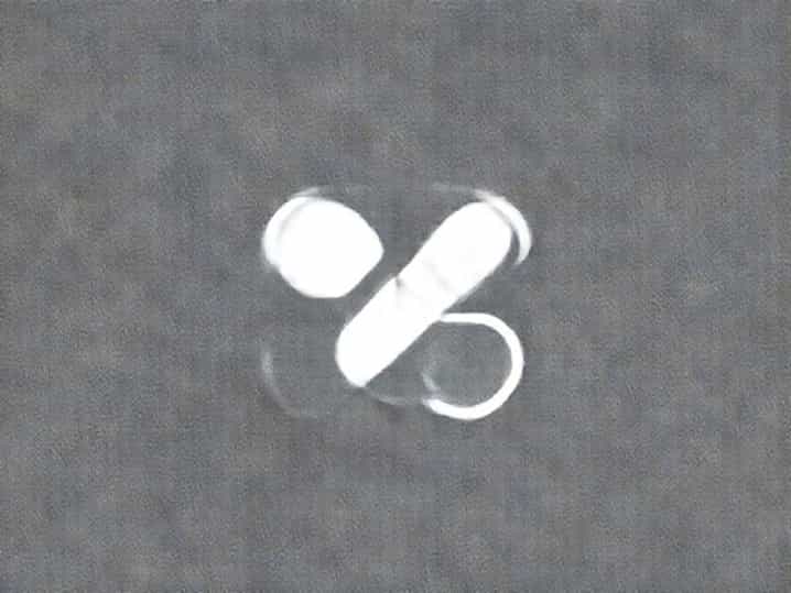 Uses Of Anticoagulant Drugs