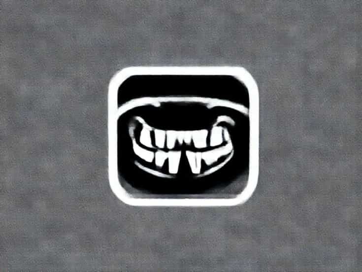 Overexposure X Ray Dental