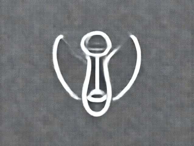 Urethral Dilation In Female