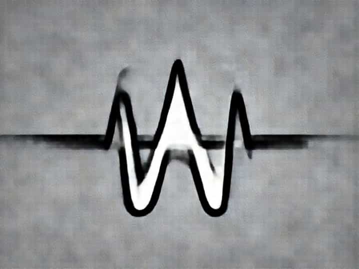 What Is Ventricular Systole