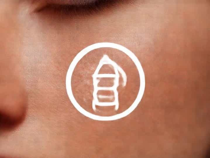 Laser Freckle Removal Cost