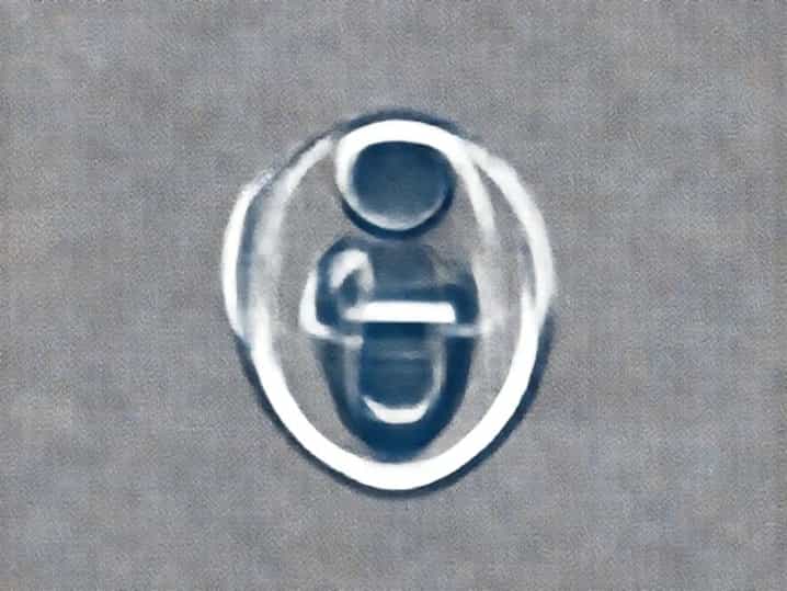 Vaginal Birth With Epidural