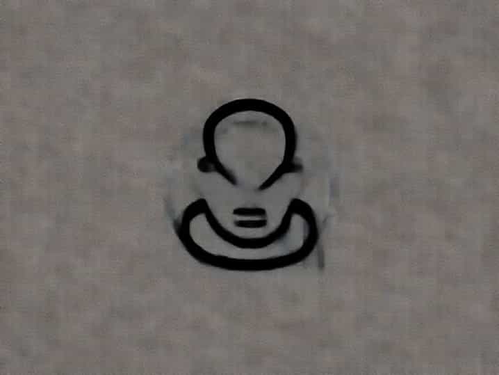 Xavier Restrepo Birth Defect