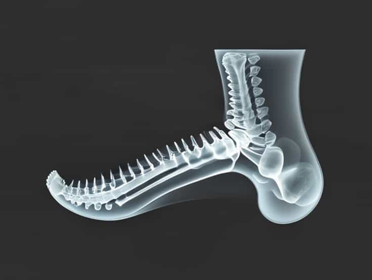 Normal Lateral Ankle Xray