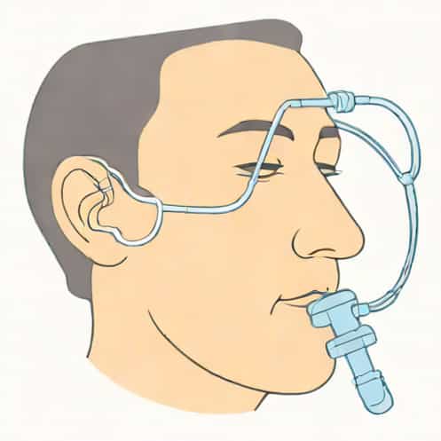 On High Flow Nasal Cannula