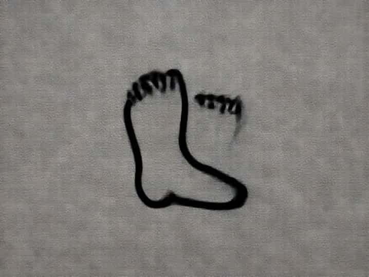 Feet Aching At Night
