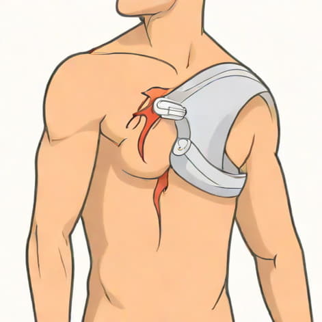 Rotator Cuff Tear Surgery