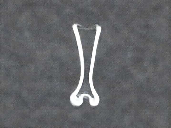 What Is Femur Length